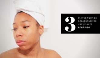 3 étapes pour se débarasser de l'acné avec acne.org